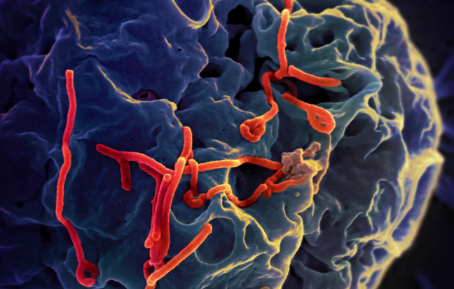 UW professor leads team that developed Ebola vaccine