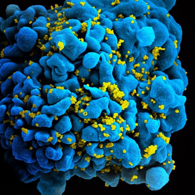 T-Cell infected with HIV