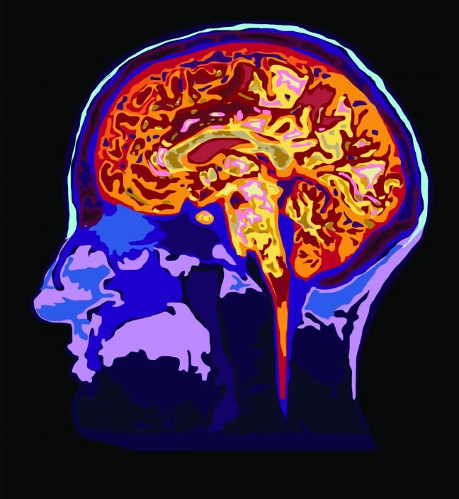 UW+researchers+discover+new+technique+to+track+brain+development
