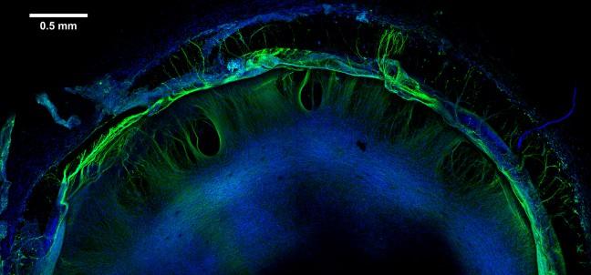 UW scientists develop brain-like structure to improve drug safety testing