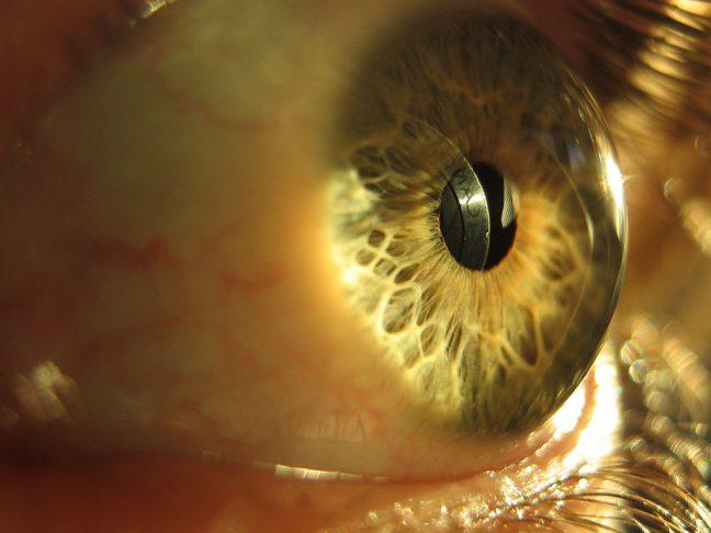 UW ophthalmology team one of six awarded $12.4 million to reverse blindness